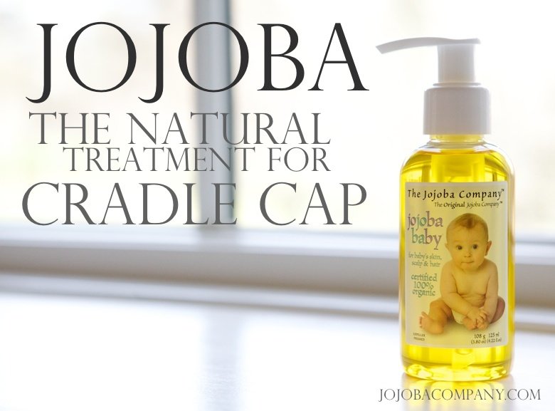 jojoba for treating cradle cap
