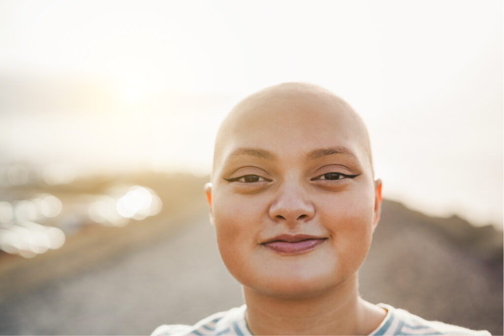 woman with bald head from cancer treatment with beautiful scalp to show jojoba is best for bald heads even from cancer treatment 